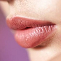 Powiększanie ust implantami silikonowymi